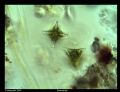 Staurastrum sp.